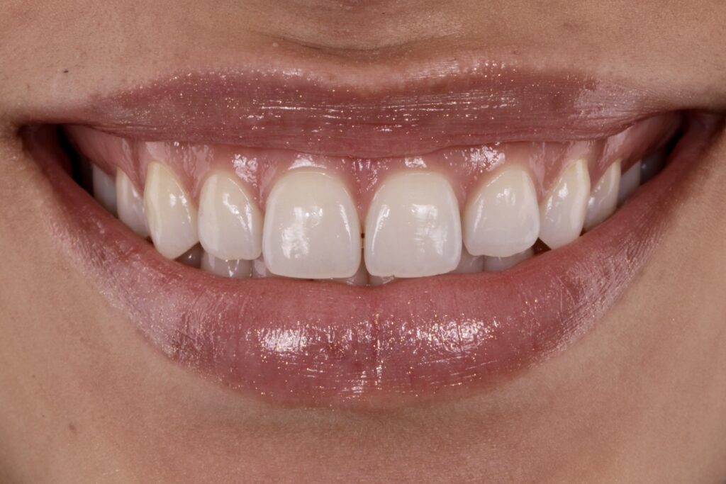 ruzzarin odontologia