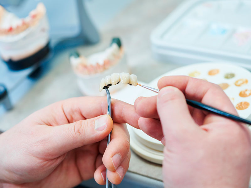Imagem de mãos segura uma prótese dentária inferior com duas pinças. Ao fundo está uma mesa com diversas próteses sobre ela e uma paleta com resquícios de tinta.