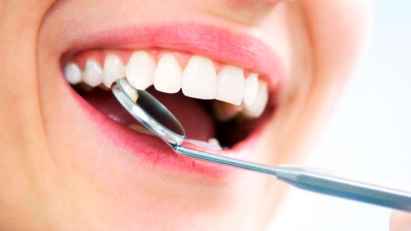 clareamento-dental-ruzzarin-odontologia