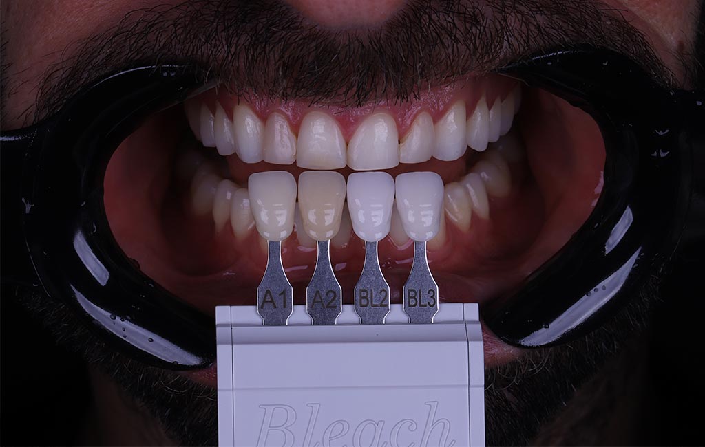 ruzzarin odontologia