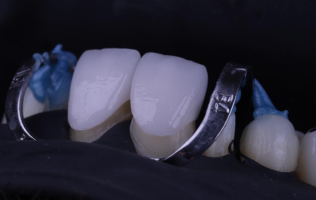 ruzzarin odontologia