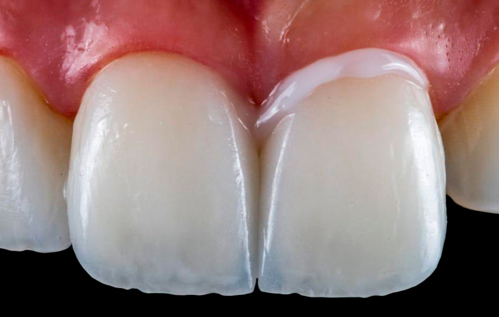 ruzzarin odontologia