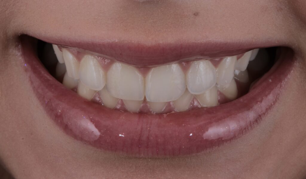 ruzzarin odontologia