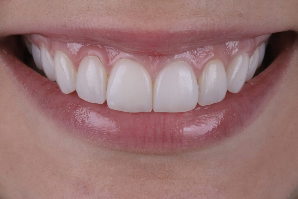 ruzzarin odontologia