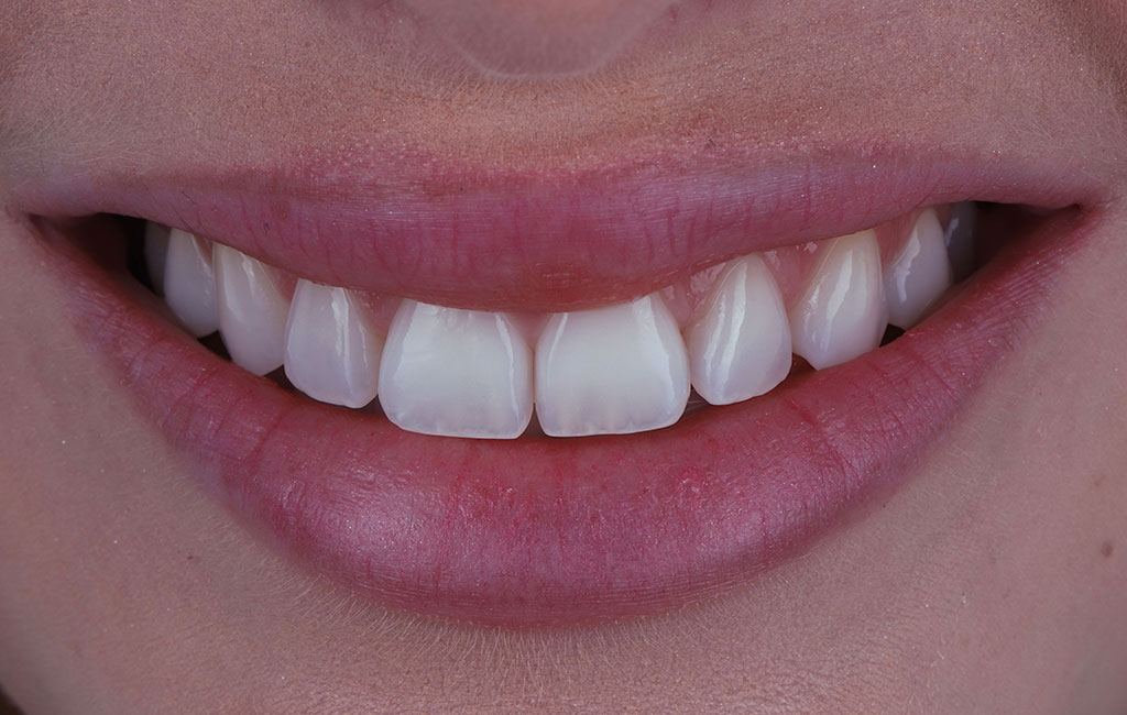 ruzzarin odontologia