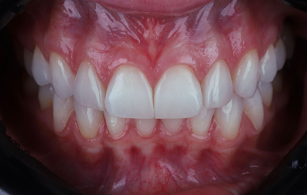 ruzzarin odontologia