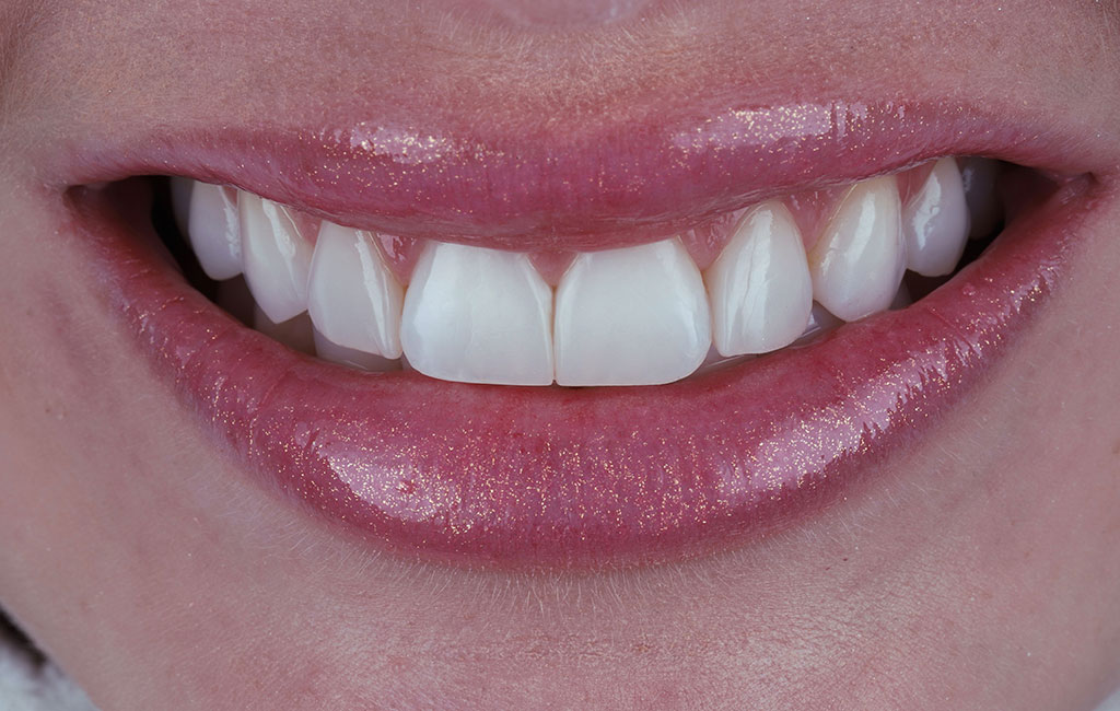 ruzzarin odontologia