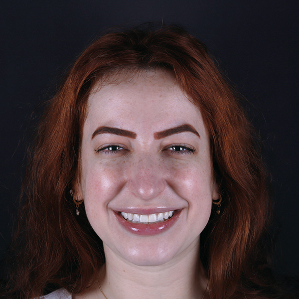 em frente a um fundo preto está o rosto de uma mulher. Ela é branca, com cabelos ruivos, e olha para frente com um largo sorriso.