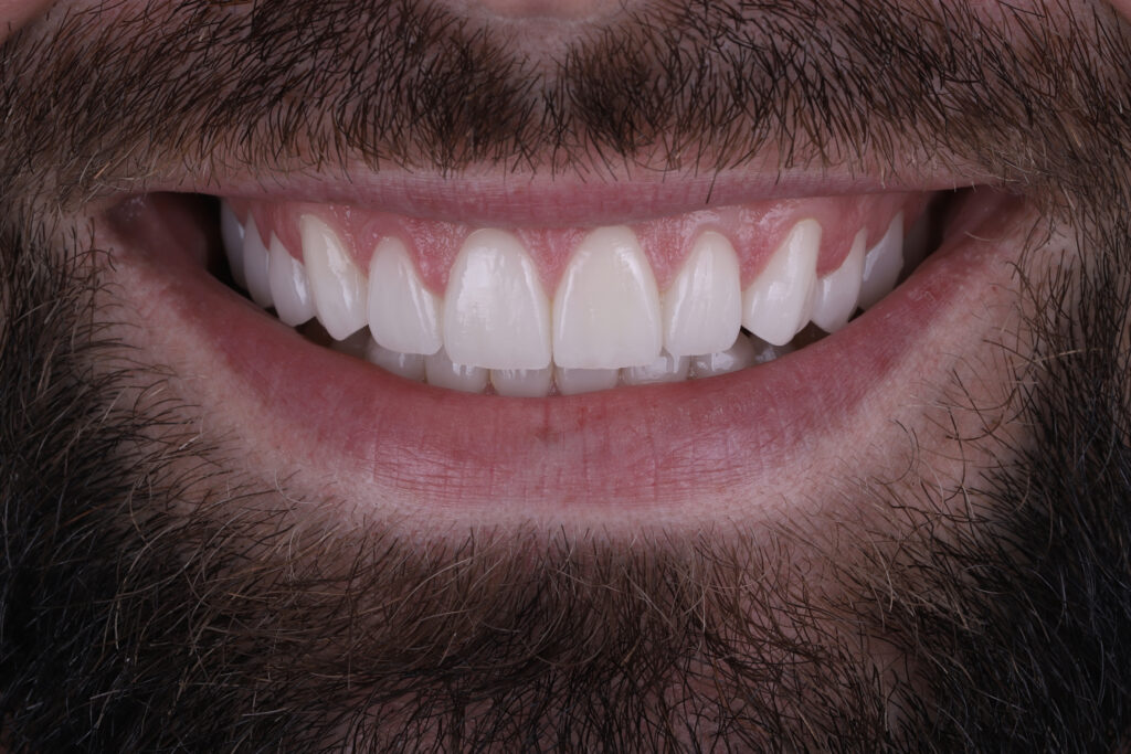 ruzzarin odontologia