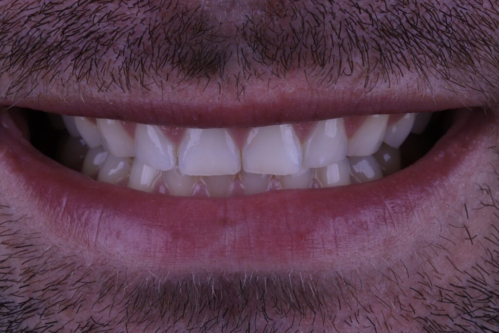 ruzzarin odontologia