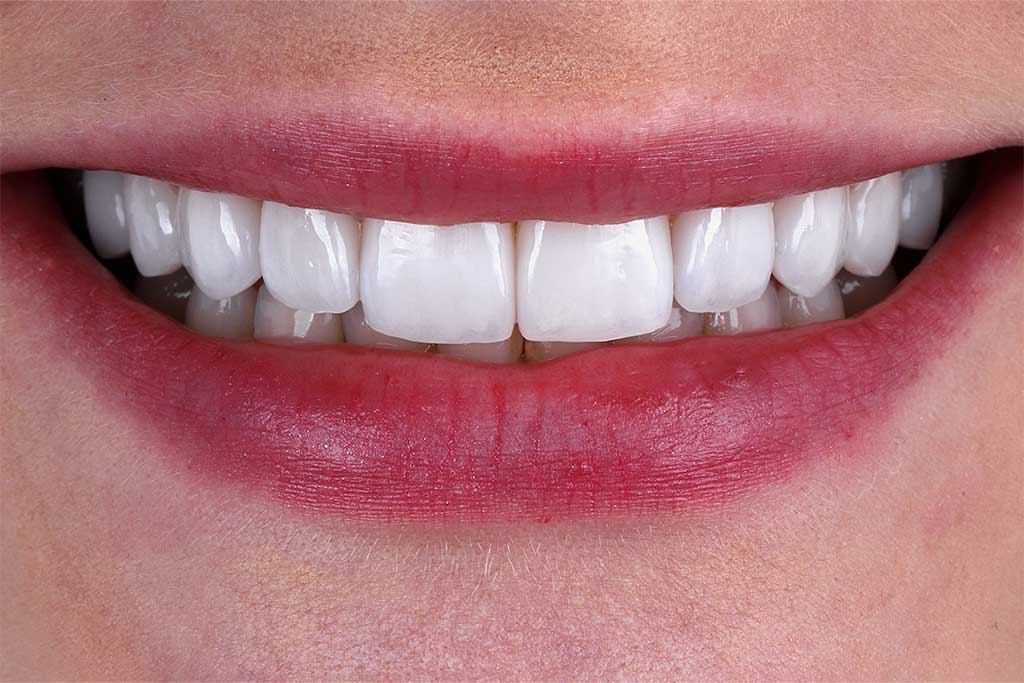 ruzzarin odontologia