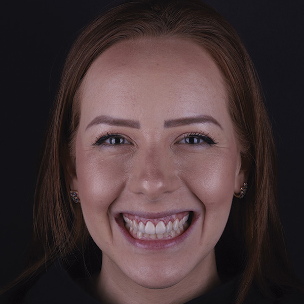 em frente a um fundo preto está o rosto de uma mulher branca, com cabelos ruivos e que usa brincos pequenos. Ela olha para frente com um largo sorriso.