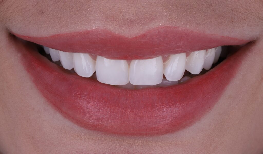 ruzzarin odontologia