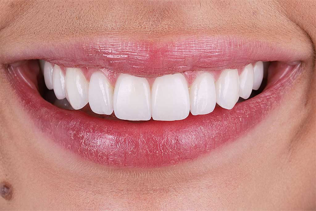 ruzzarin odontologia