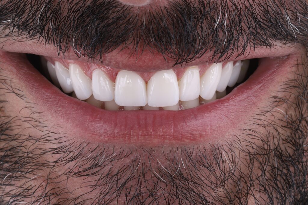 ruzzarin odontologia