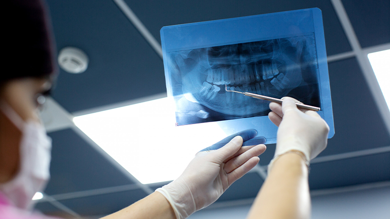 Mais à esquerda da imagem, está uma dentista, que segura, contra a luz, um raio-x da boca de um paciente e aponta com um instrumento odontológico para uma área onde não há um dos dentes. O fundo da imagem é cinza.