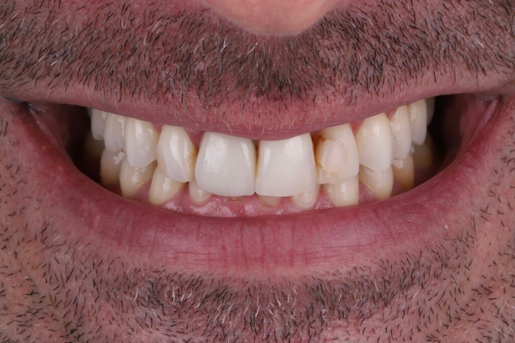 ruzzarin odontologia