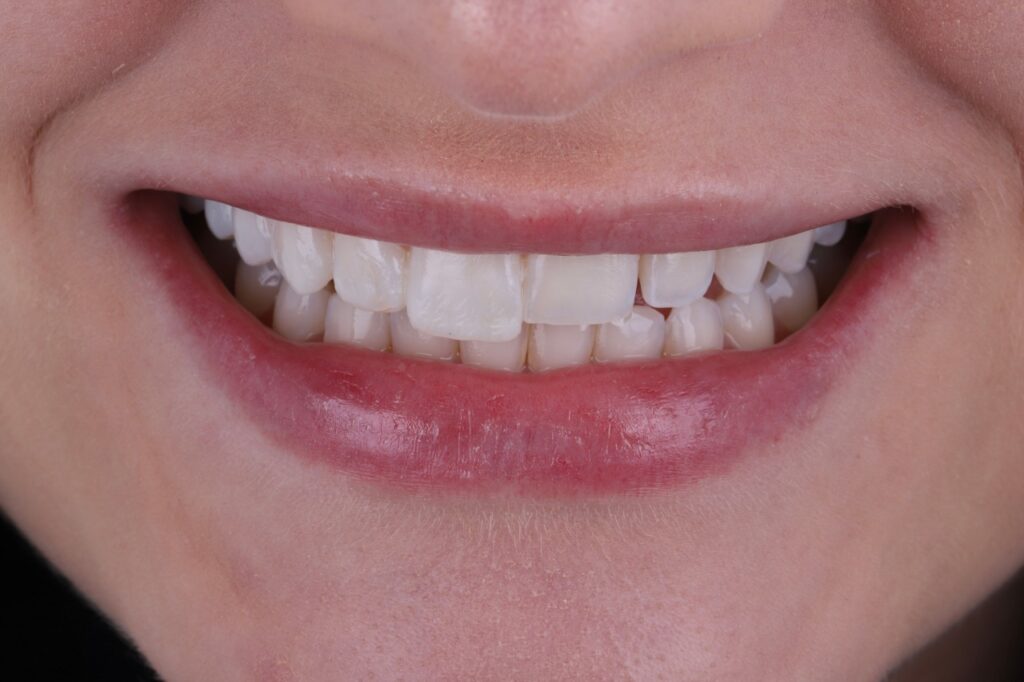 ruzzarin odontologia