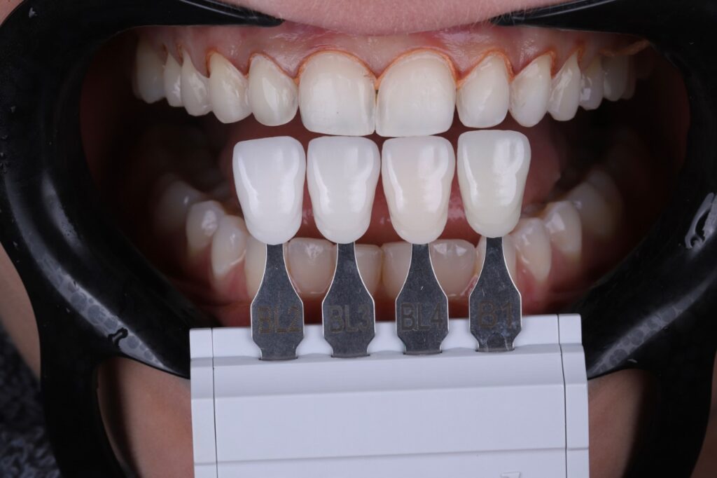 ruzzarin odontologia