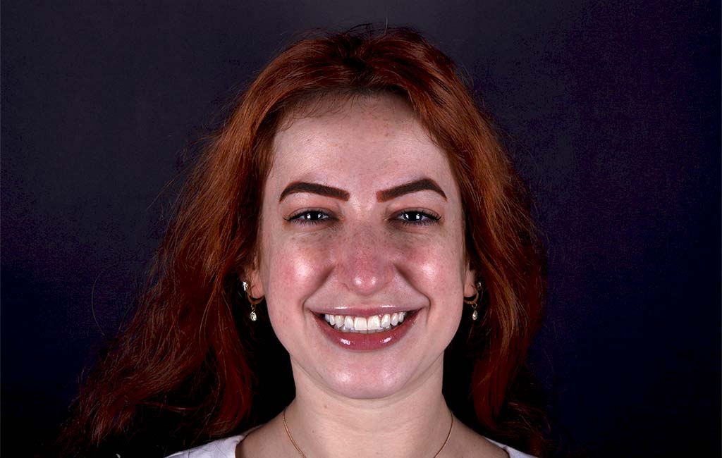 ruzzarin odontologia