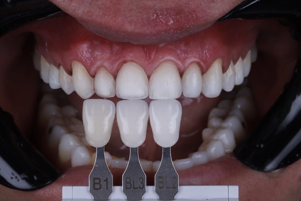 ruzzarin odontologia