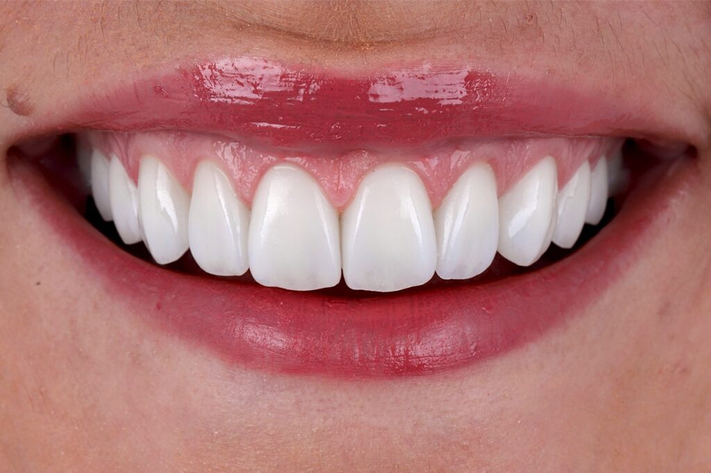 ruzzarin odontologia