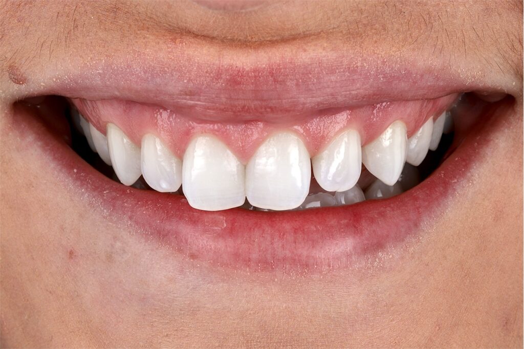 ruzzarin odontologia