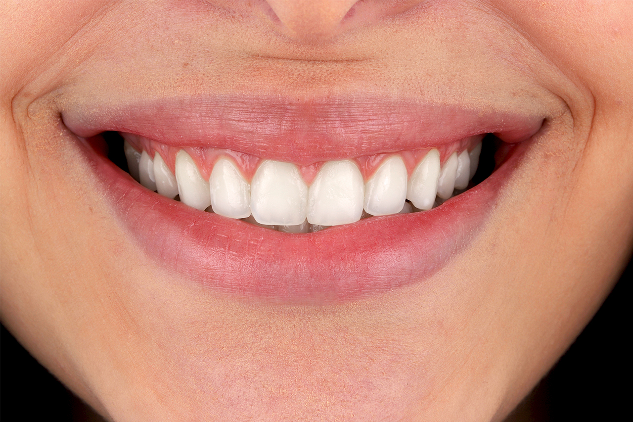 ruzzarin odontologia