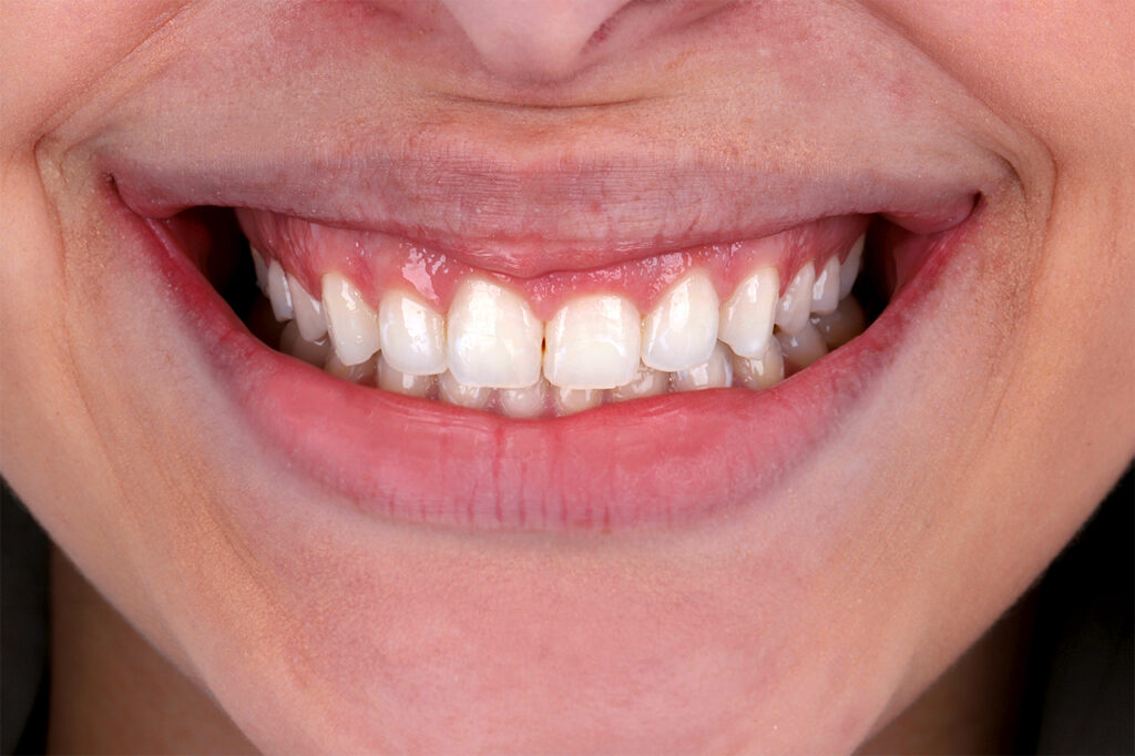 ruzzarin odontologia