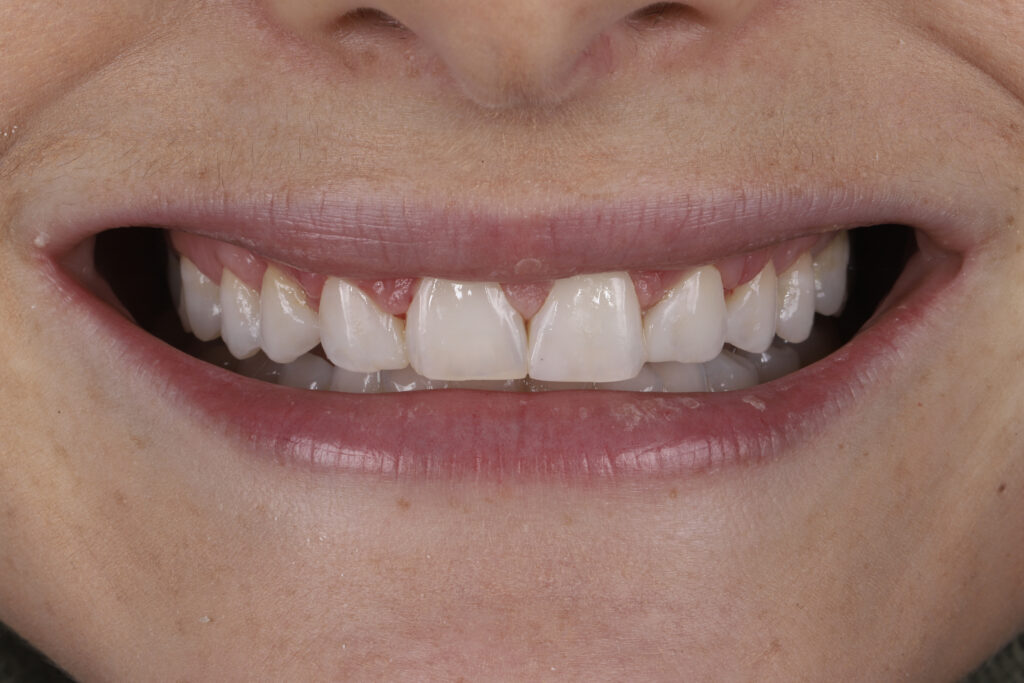 ruzzarin odontologia