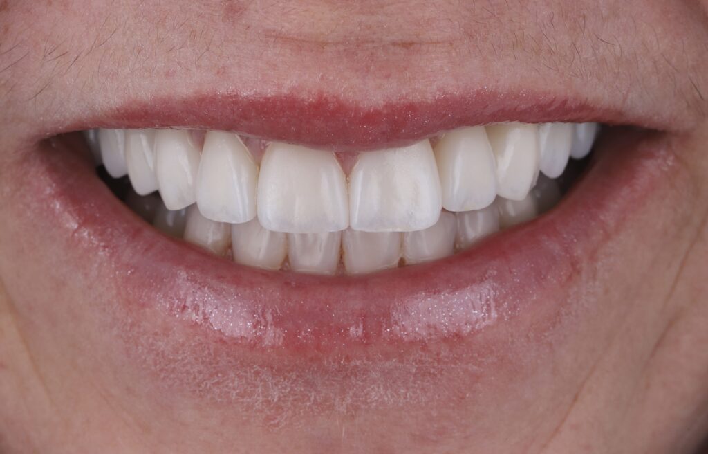 ruzzarin odontologia