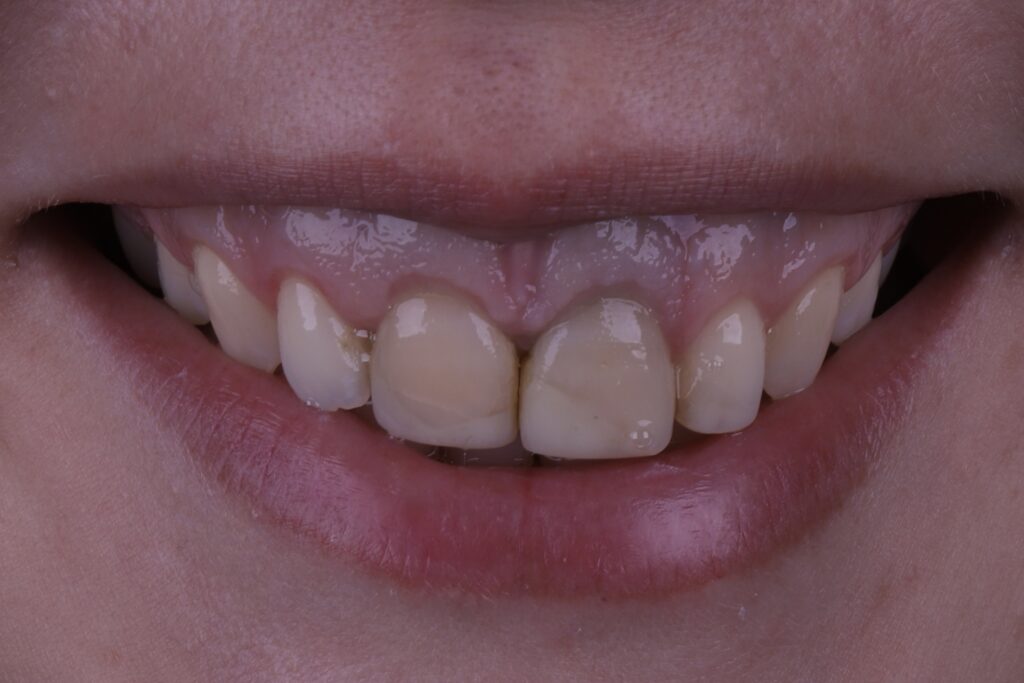 ruzzarin odontologia